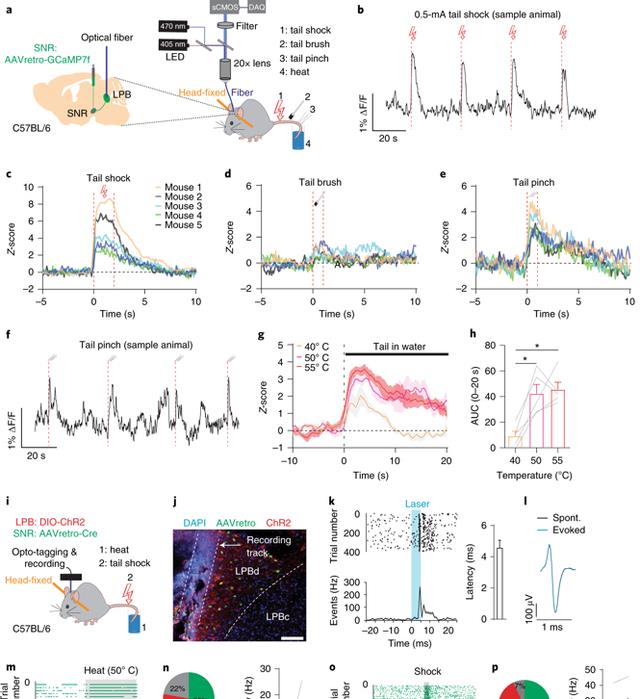 空间站 疼痛影响大脑中多巴胺活动（fMOST技术再次助力神经环路研究）