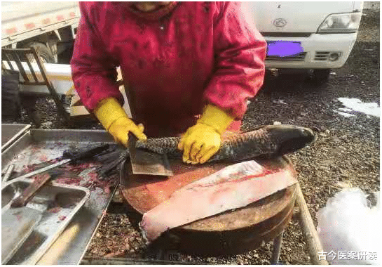 钟南山|47岁大姐肠癌离世，医生叹息：这种“粗粮”，白送也不能再吃