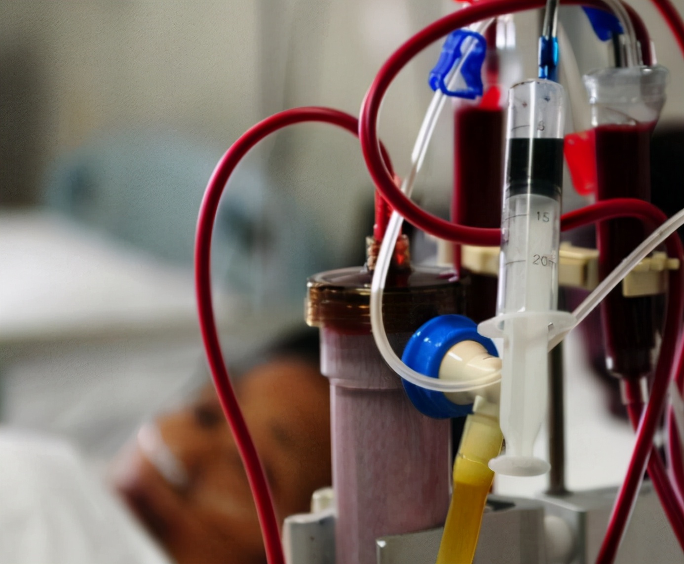 尿酸|出租女司机“内卷”7年,确诊肾衰离世,医生:“内卷”害人不浅