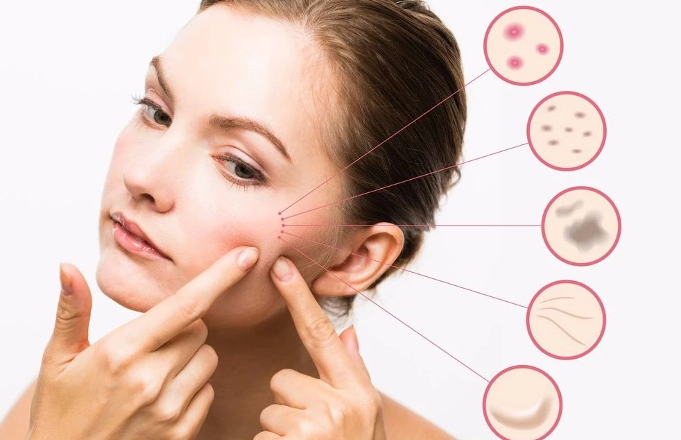 公西碧曼|32岁女子为了淡斑,怒喝三个月的番茄汁,结果怎么样了?