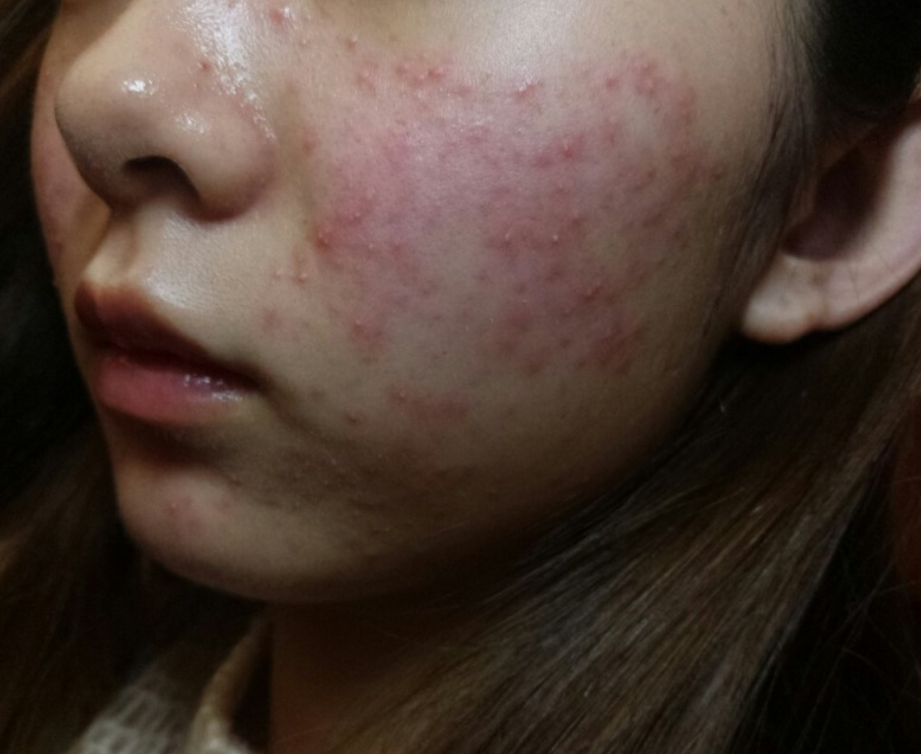 防晒|还在为皮肤问题烦恼吗？教你几招，轻松改善肤质问题