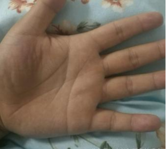 玄何师傅讲命理|手相看婚姻，你的婚姻是否能美满幸福？