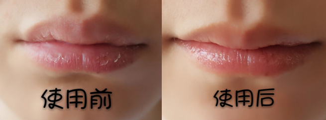 润唇膏 孕期也能拥有果冻唇嘟嘟唇！秋冬买唇膏就买这5款，滋润不油腻