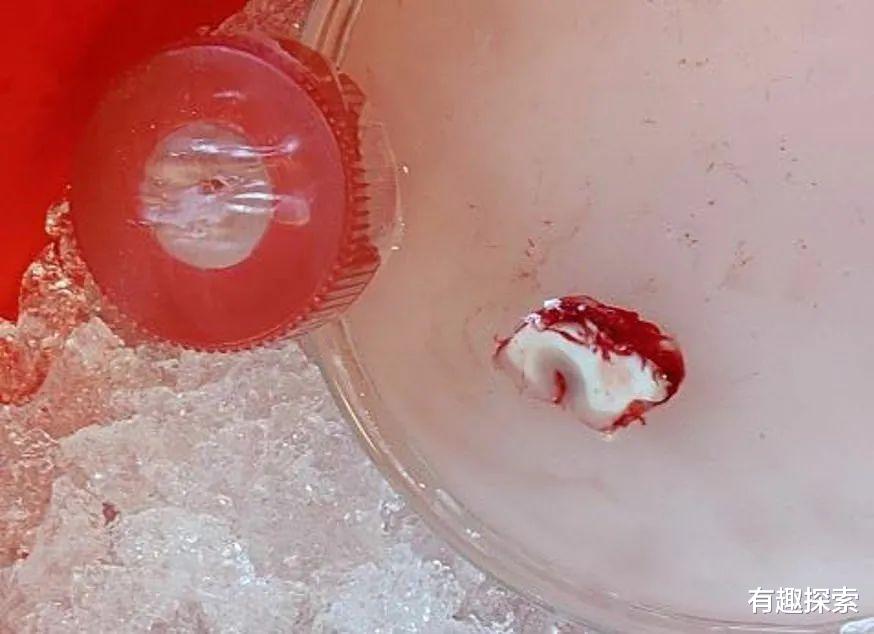 突破性研究!人脑切片离体后仍存活12小时,大脑会感觉到痛吗?