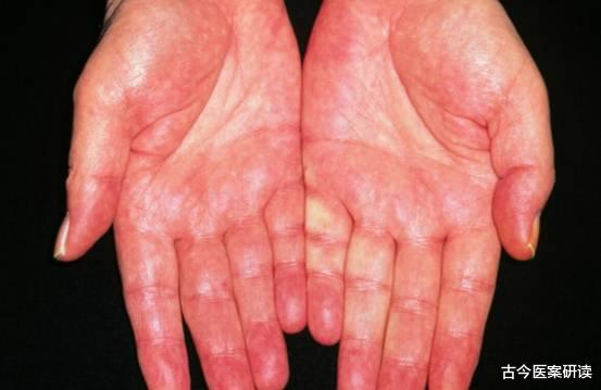 肝脏|排毒“扛把子”已公布，不是大蒜，饭后敞开吃，肝内毒素越来越少