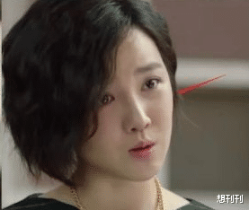 后遗症|做了颧骨内推的明星真的变美了吗?推平容易后悔难,后遗症一大堆