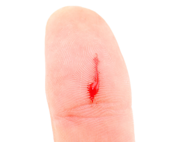 项目才能相册 34岁单亲妈妈查出宫颈癌,3个月后离世,医生叹息:饭后忌1件事