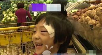 吴镇宇|吴镇宇儿子费曼近照：眼角疤痕仍触目惊心，当时气得怒摔话筒