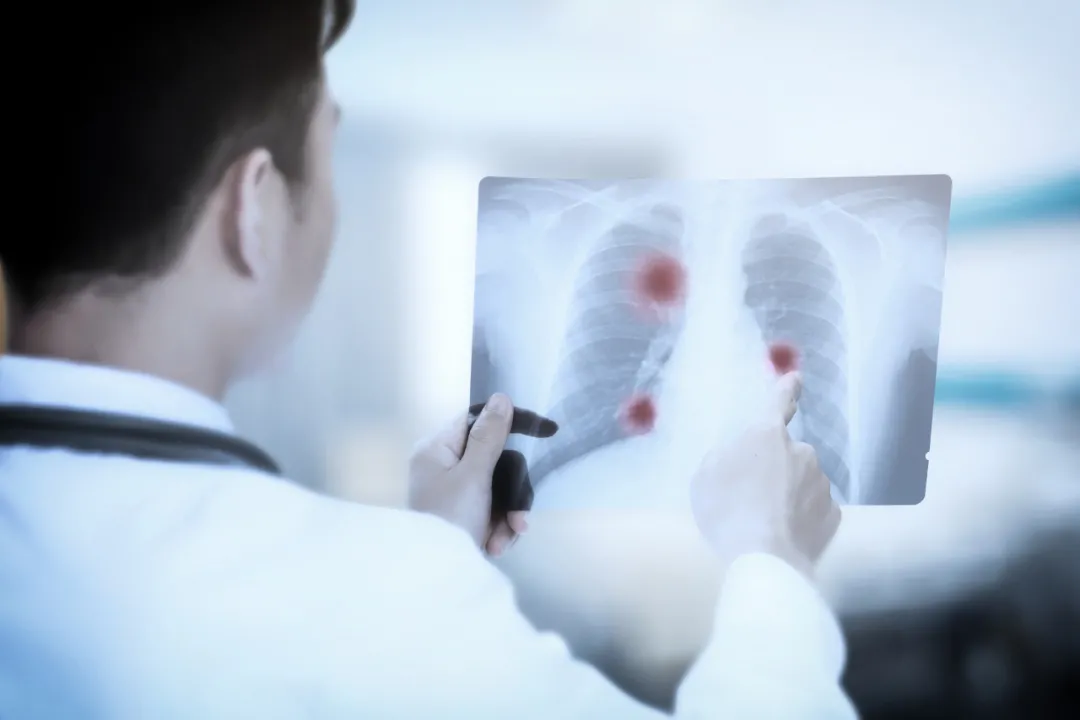 常笑健康 全家都不抽烟，为什么偏偏妈妈患癌？这个危险因素已经被忽视几十年！