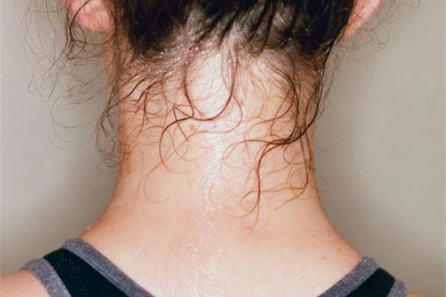 深度养生知识|认识中药：了解一下银柴胡，清虚热之外，和“金银”没有关系