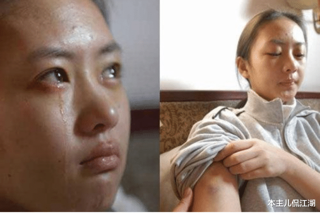童瑶|18年前，童瑶被张默暴打，沉寂多年后，她的报复手段太解恨