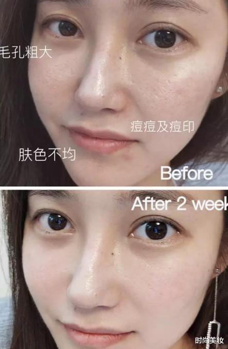 时尚美妆|孙艺珍的素颜照惊艳到我了！皮肤嫩得掐出水，旁边的素人好吃亏