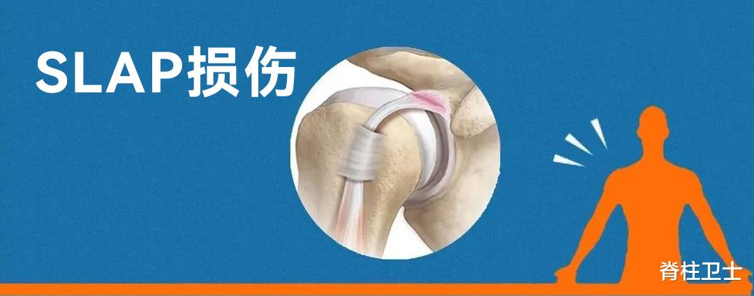 高血脂|这几个常见的肩痛原因你了解吗？什么时候要康复？