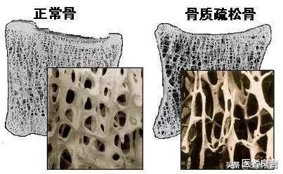 更年期|更年期到底有多可怕?