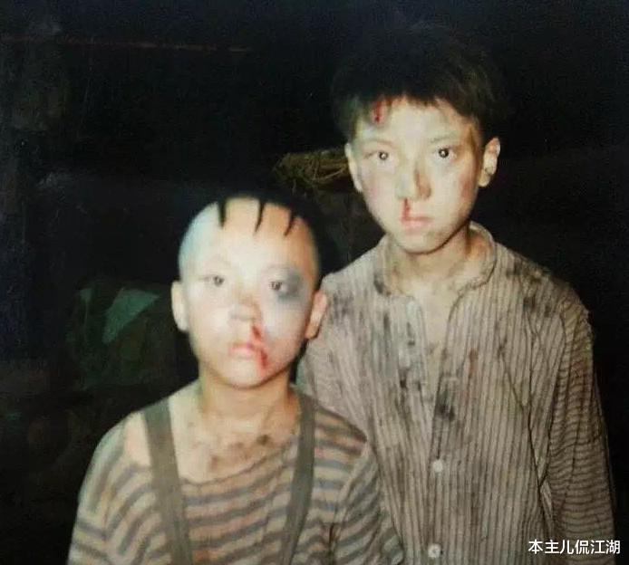 孟智超|8岁成名，14岁秃顶，植发挨300多针不后悔，还记得“三毛”孟启超吗