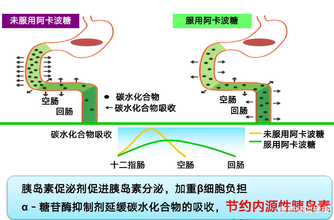 李药师谈健康|阿卡波糖是如何正确控制血糖的？本文给你讲明白