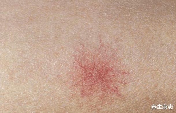 肝脏|男性晨起有4种“异常”,肝或已“伤痕累累”,若你没有,肝还比较强壮