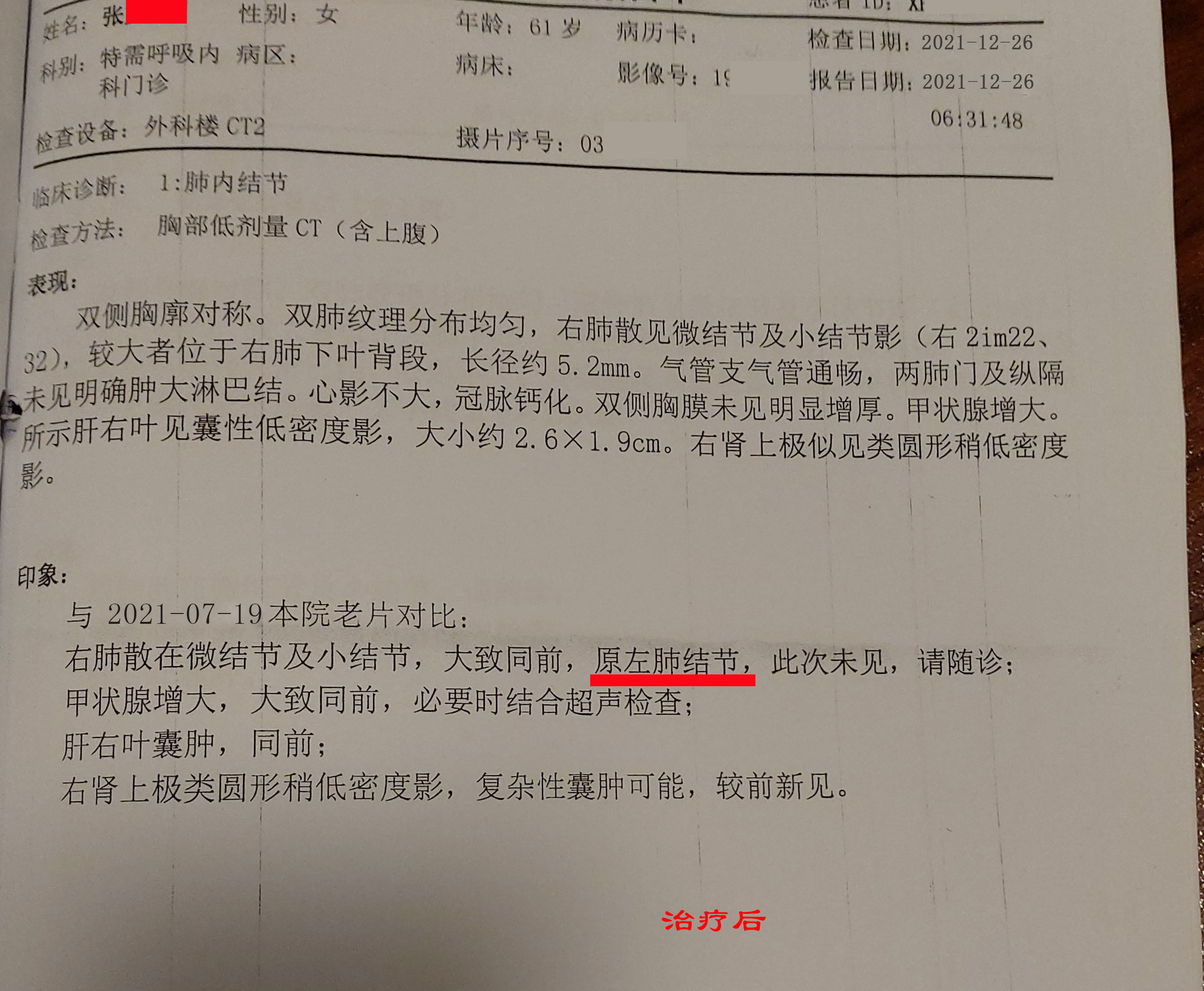 咳嗽|咳嗽有痰,不易咳出,爱发脾气,多是肺结节,中药调理4月后改善