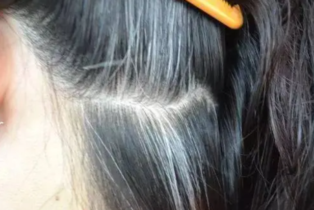 白发|有了白发先别着急染发，多吃5种食物，或能改善