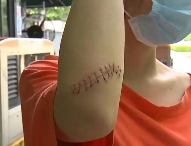 ETF 浙江杭州：醉酒女子拒不出示健康码，踹碎大门被割伤起诉物业 法院：只能赖你自己！