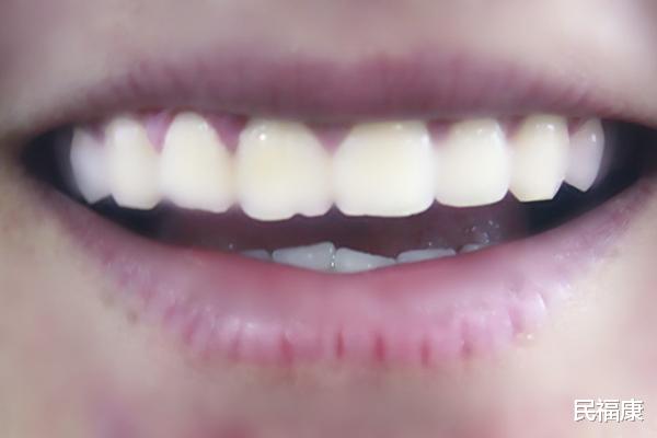 牙齿|牙齿好才能胃口好，口腔卫生小知识你了解多少？不妨自查看看