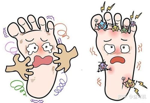 旗峰说健康|缓解脚气,不再尴尬