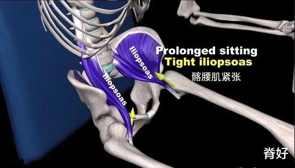 臀部|唤醒和激活“它”，让你跟腰疼说拜拜