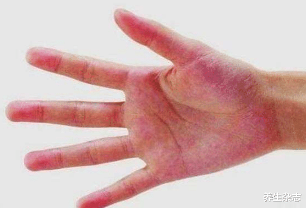 肝脏|身体这2处发生疼痛，是肝脏发出的“求救”信号，小心癌变的发生