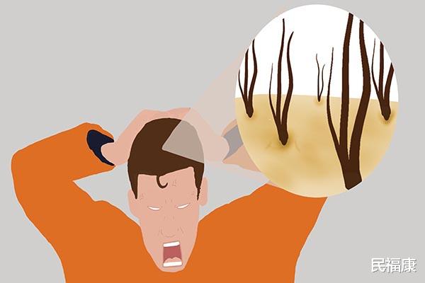疾病|为什么头皮上经常长脓包和疙瘩,什么原因造成的?了解五方面
