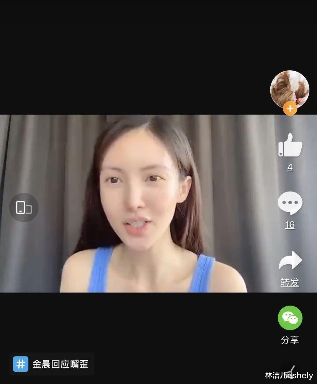 林洁儿ashely|盛世美颜还有好气质的金晨，竟然有脸歪bug？郑秀妍也有同样缺陷