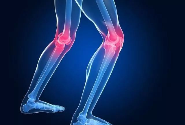 食管癌|年过40岁，小心骨关节炎，不请自来