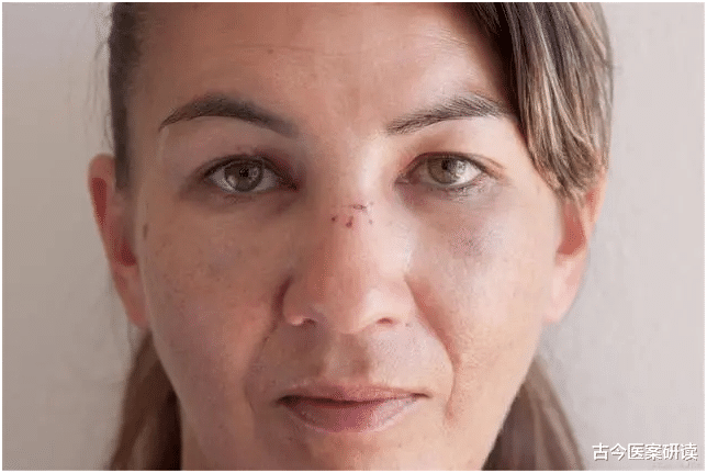 长寿|胃病“克星”已经找到，如果你天天吃1物，胃更健康，口臭消失不见