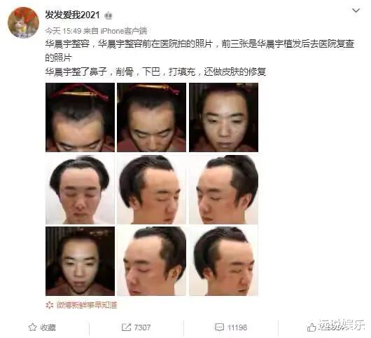 岳云鹏|惹上疯女人？华晨宇栽了，猛料全被曝光