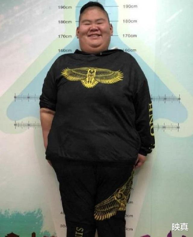 长寿 “中国第一胖”王浩楠:小学毕业已300斤,一年减363斤并收获爱情