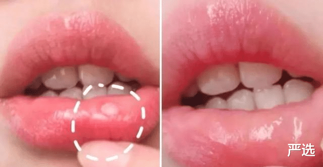 严选 刷牙时牙膏是否要先沾水?很多人不晓得,怪不得牙齿黄黄的