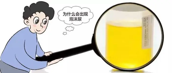 麦吉科普|尿有泡沫，是不是肾不健康了？出现这4种情况时，可能真是肾病