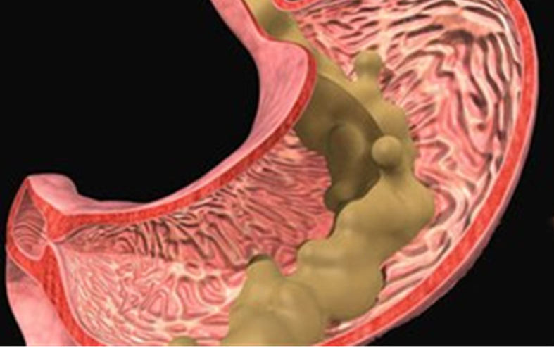 钟南山|85岁钟南山公开三餐饮食原则：做到“3吃3不吃”，难怪胃好身体好