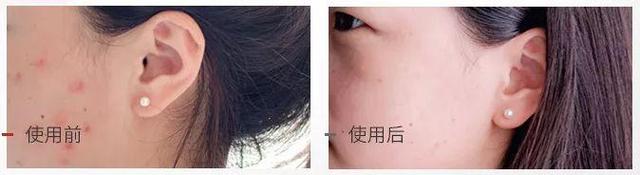 好物官|43岁李小冉拍照自带滤镜，皮肤细腻白嫩零毛孔，网友：真冻龄女神