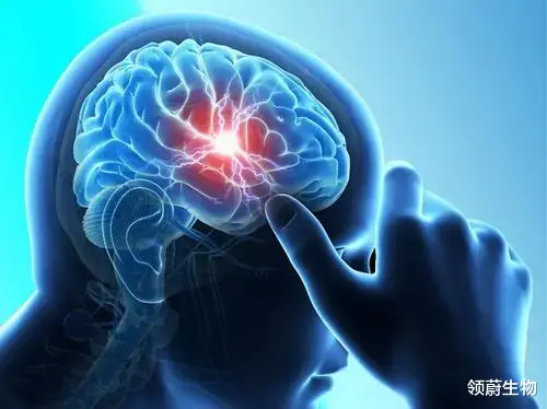 对付脑卒中,干细胞疗法任重道远