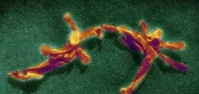  食人部落与“笑死病”：为何哺乳动物不能同类相食？