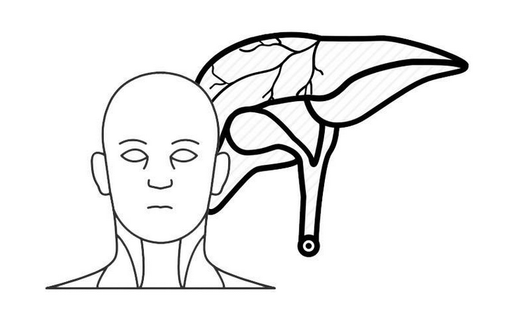 肝癌|越来越多的人患上肝癌！医生告诫：这个饮食习惯真得改，伤肝！