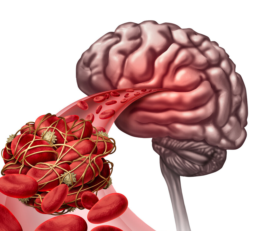 养生早班车|血管变堵,这些常通血管的食物要常吃!心血管疾病患者别错过了