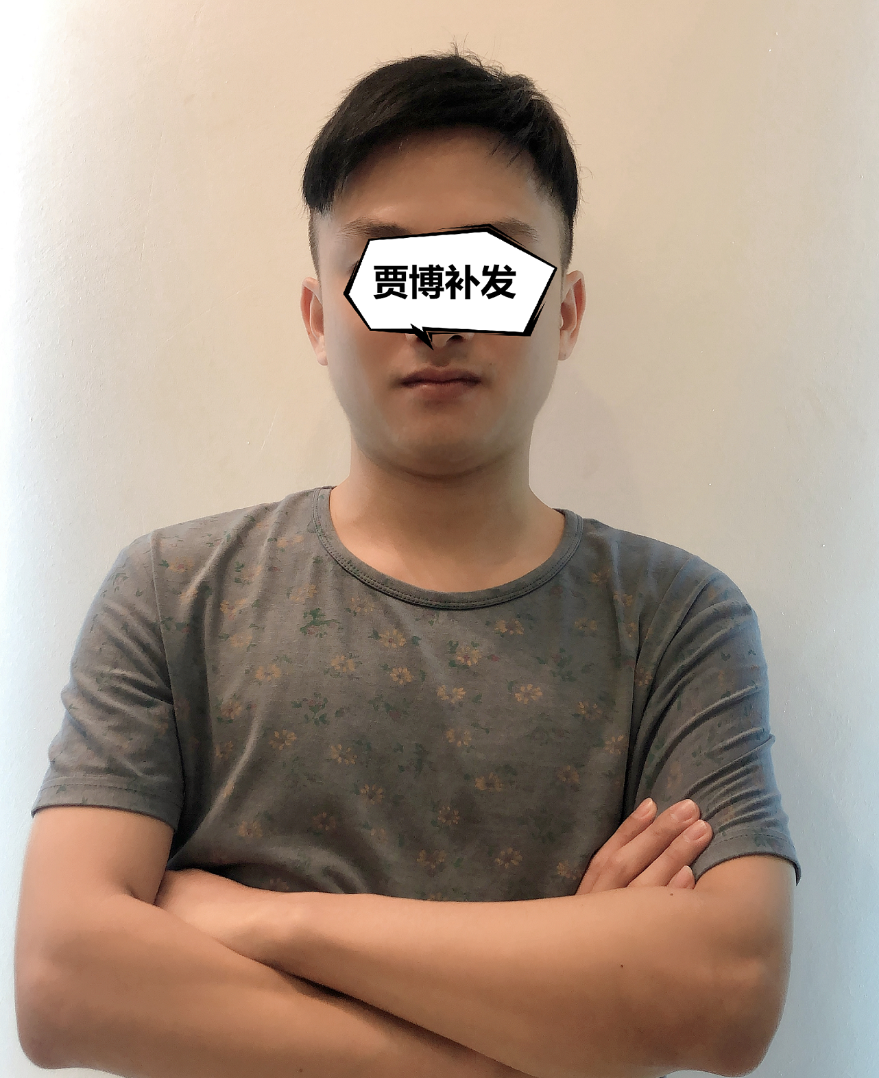 GabalMan贾博补发|不到2小时，浓密头发回来了！记录他的逆袭过程