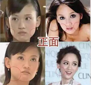 整容|10位当红女星整容前后：顿时感觉我也能出道了哈哈