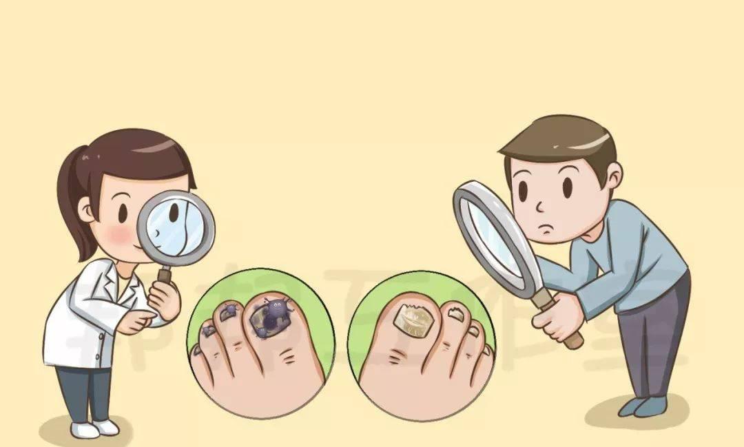 清源净流|你真的了解灰指甲吗？治疗灰指甲要避免五大误区