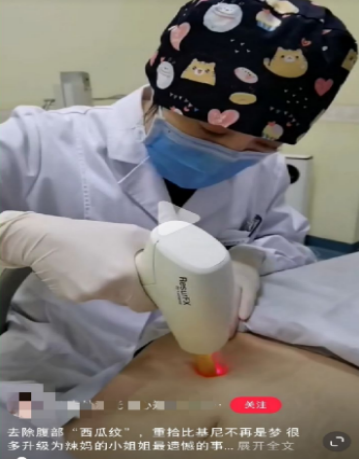 fashion美尚|那些号称可以“预防妊娠纹”的方法和乳油膏霜，原来都是智商税