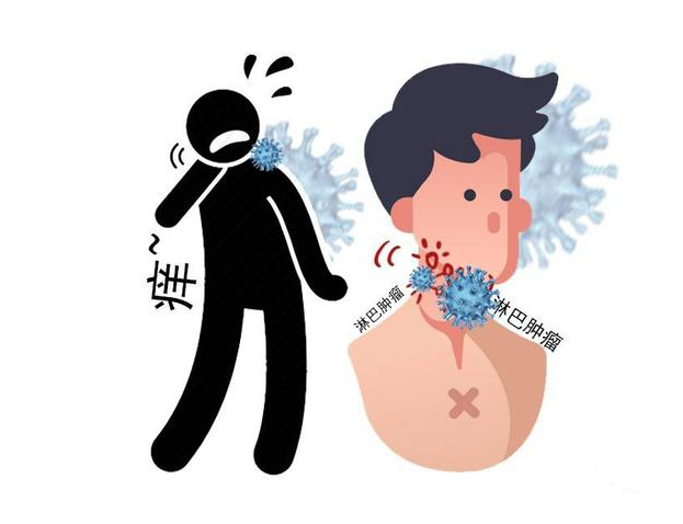 喉癌|喉癌发出的第一个信号，往往在嘴巴里，这种异常，希望你没有！