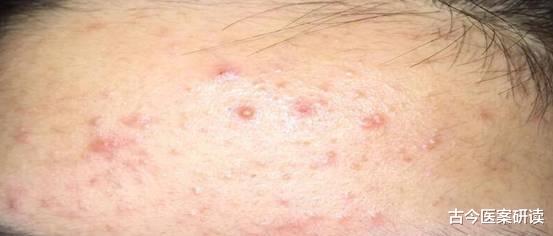 便秘|通便“王”并不是香蕉，而是“它”，连喝1周，便秘、口臭绕路走