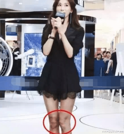 林志玲|林志玲两年未有身孕被嫌弃，传家暴住院，婚姻状况一目了然