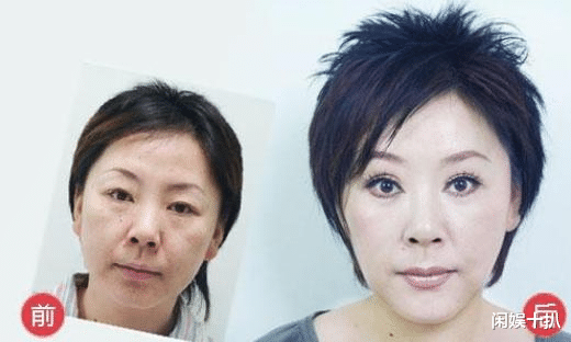 衡越|衡越：赵本山的御用歌手，被骗财骗色，花60万整容2年又长回去了